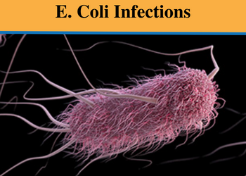 5 Year Multicenter Study – E. Coli Infections